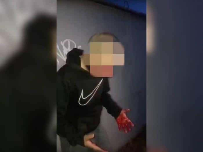«В кровь прям» — на Урале подростки зверски избили пятиклассника 