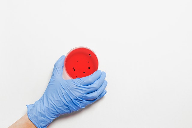 В Свердловской области зарегистрировано 733 новых случая COVID-19 В Свердловской области зарегистрировано 733 новых случая COVID-19