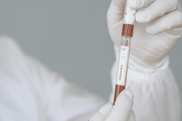 На Среднем Урале выявлено ещё 695 случаев COVID-19 На Среднем Урале выявлено ещё 695 случаев COVID-19