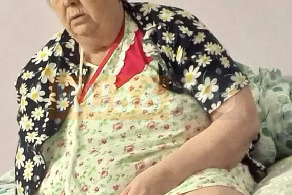 На Урале пациентке сломали руку во время УЗИ