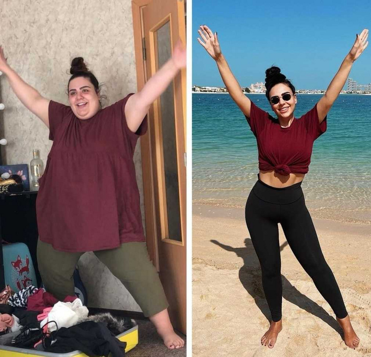 Тюменский блогер удалила пять килограммов кожи Тюменский блогер удалила пять килограммов кожи