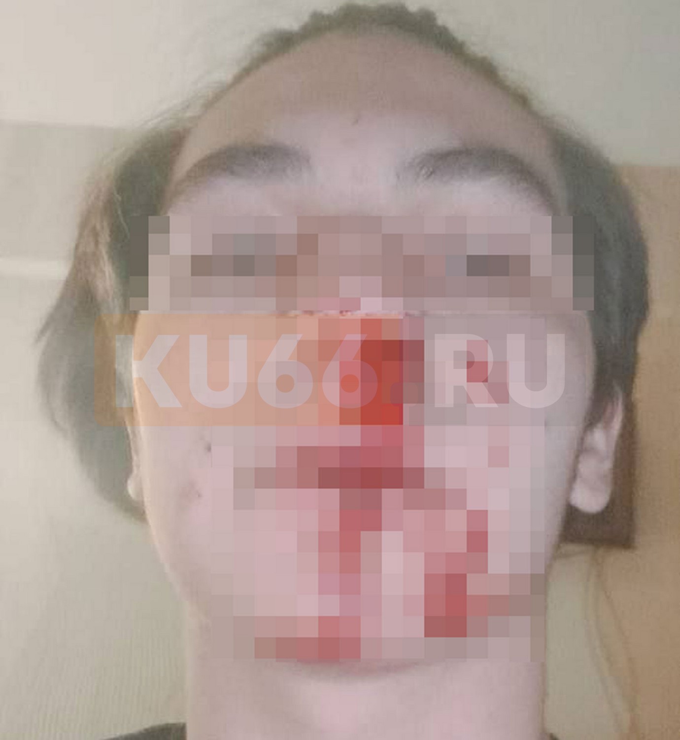 В Каменске-Уральском госорганы попустительствуют неизвестным, жестоко избившим подростка?  | В Каменске-Уральском госслужбы замалчивают жестокое избиение подростка 