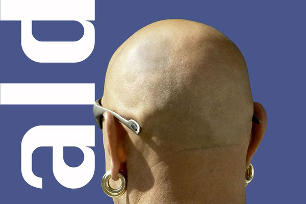 Назван новый способ избежать облысения | Учёные признали сахар лекарством от облысения