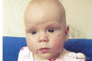 Для маленькой Даши собирают деньги на лечение рака глаз