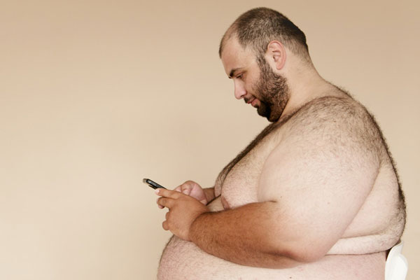 Михаил Мурашко объявил: россияне с лишним весом получат помощь за счёт государства | Хирургическая помощь россиянам с ожирением стала доступна по ОМС